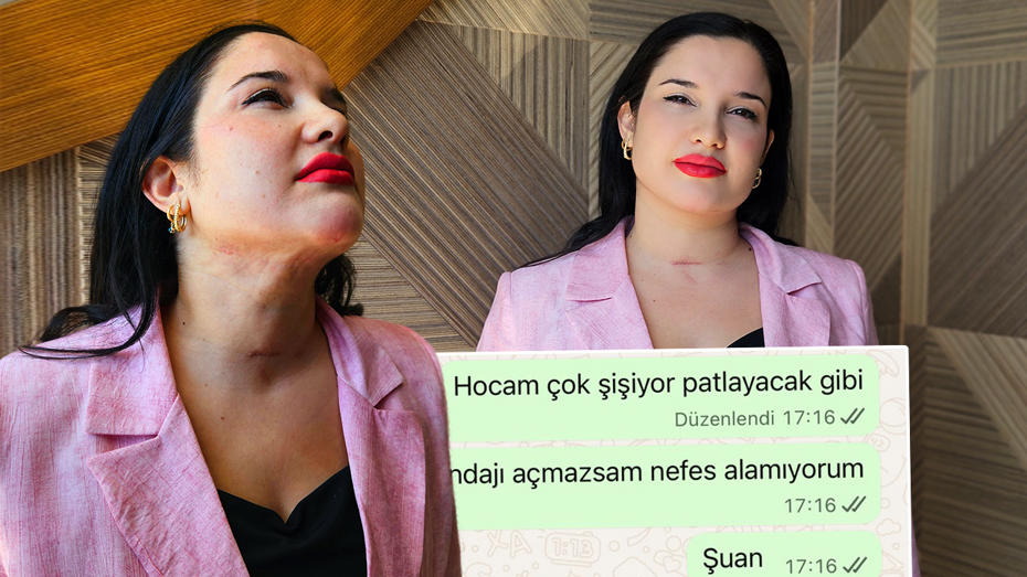 Estetik Operasyonundan Dönen Kadın 5 Milyon Lira Tazminat Talep Etti