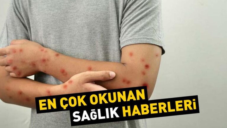 21 Ağustos 2024 günün öne çıkan sağlık haberleri…