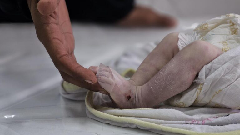 Gazze'de donarak ölen çocukların sayısı 7'ye çıktı